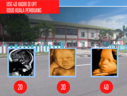 Layanan USG 4 Dimensi (4D) Hadir di UPT RSUD Kuala Pembuang